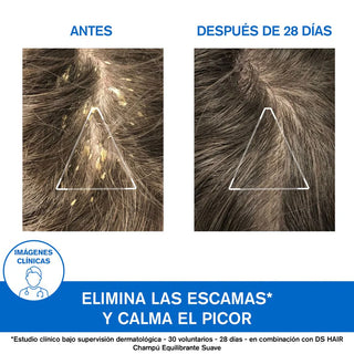 URIAGE DS HAIR SHAMPOO DE TRATAMIENTO QUERATOREDUCTOR