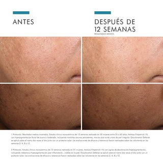 SKINCEUTICALS DISCOLORATION DEFENSE 30ML